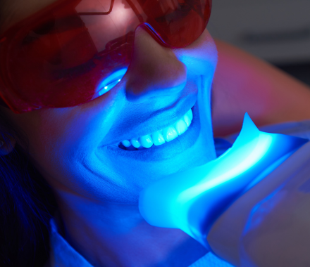 Blanqueamiento de alta calidad en Coraldent Clínica Dental